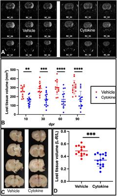 Microglial re-modeling contributes to recovery from ischemic injury of rat brain: A study using a cytokine mixture containing granulocyte-macrophage colony-stimulating factor and interleukin-3